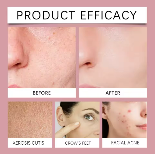 Visible Skin Transformation